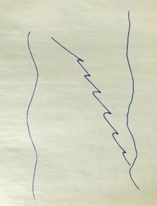 Squiggly lines